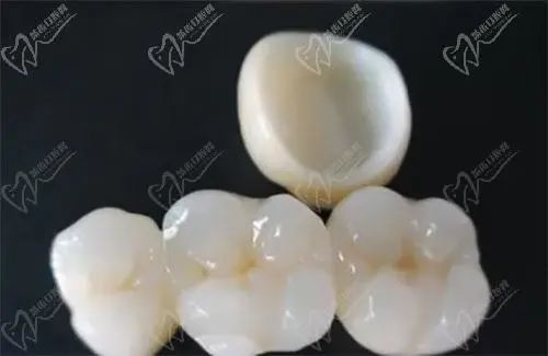 时代前沿的全瓷牙技术，齿科领域的革新之光