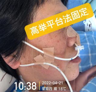 胃管最新固定方法详解，图片展示、学习变化与自信成就的力量