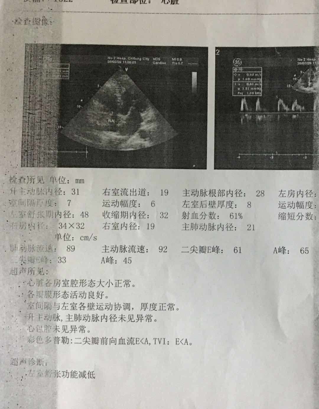 最新赤峰肺炎动态，全面解读与观点阐述